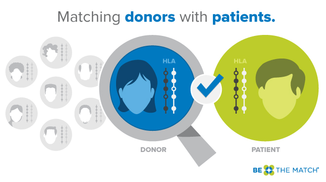 Matching donors with patients